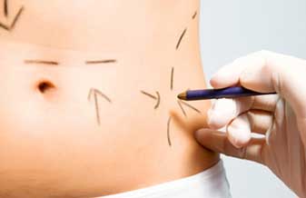 Rosenberg Fundao Azevedo - Foto 1