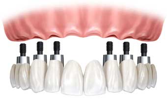 Laboratório de Prótese Rogério Lama - Foto 1